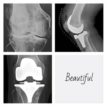 Slider image (7) Dr. Rodrigo Aguirre Rojas Orthopedic Surgeon